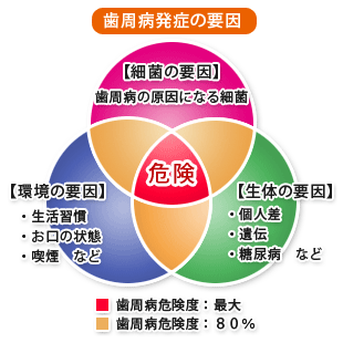 歯周病発症の要因