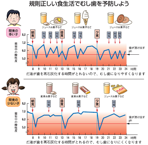 図解：規則正しい食生活で虫歯を予防しよう。間食が多いと唾液が歯を再石灰化する時間が取れず虫歯になりやすい