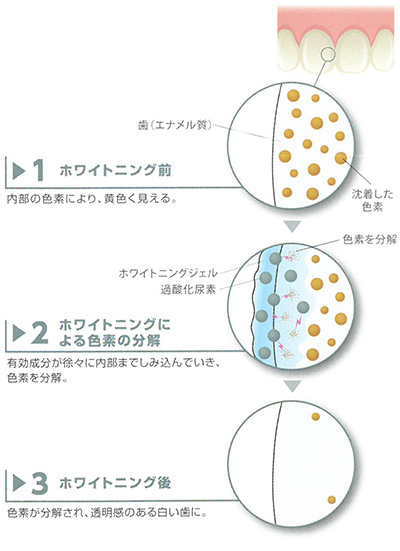 ホワイトニングのメカニズム