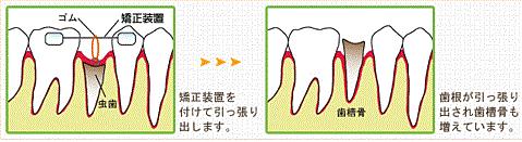 MTM治療